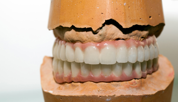 Repair Options For Partial Dentures