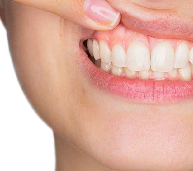 Tulare Gum Disease