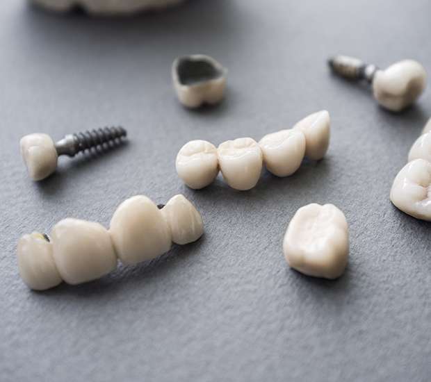 Tulare The Difference Between Dental Implants and Mini Dental Implants